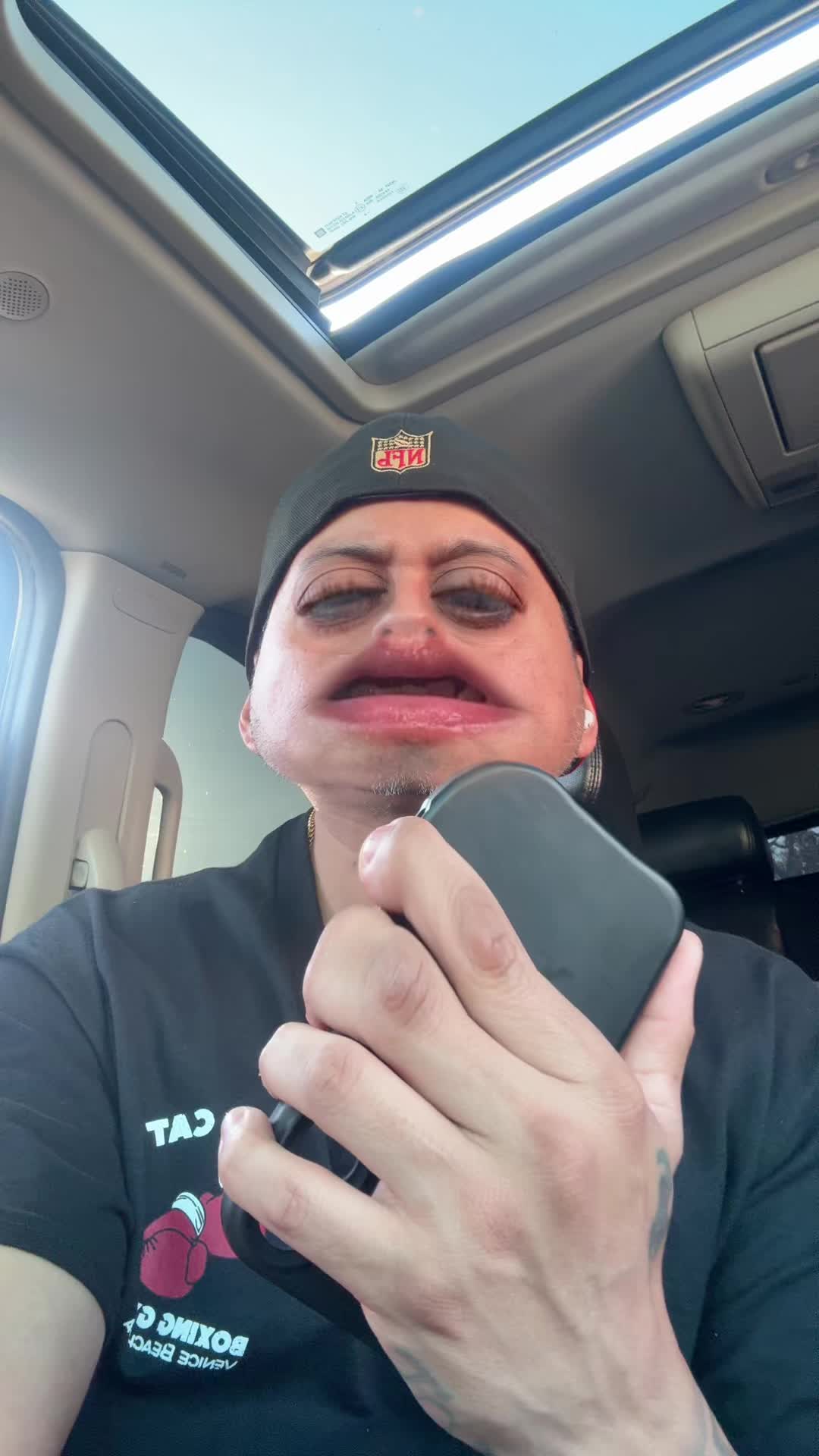 @MP