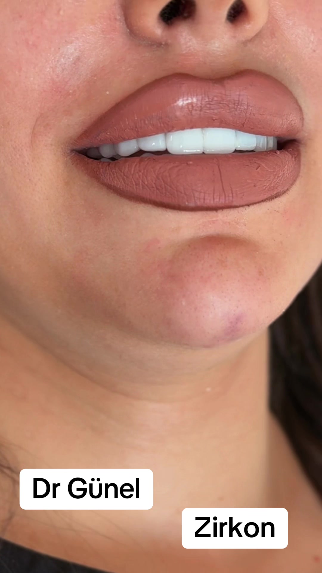 @Dentist_Günel