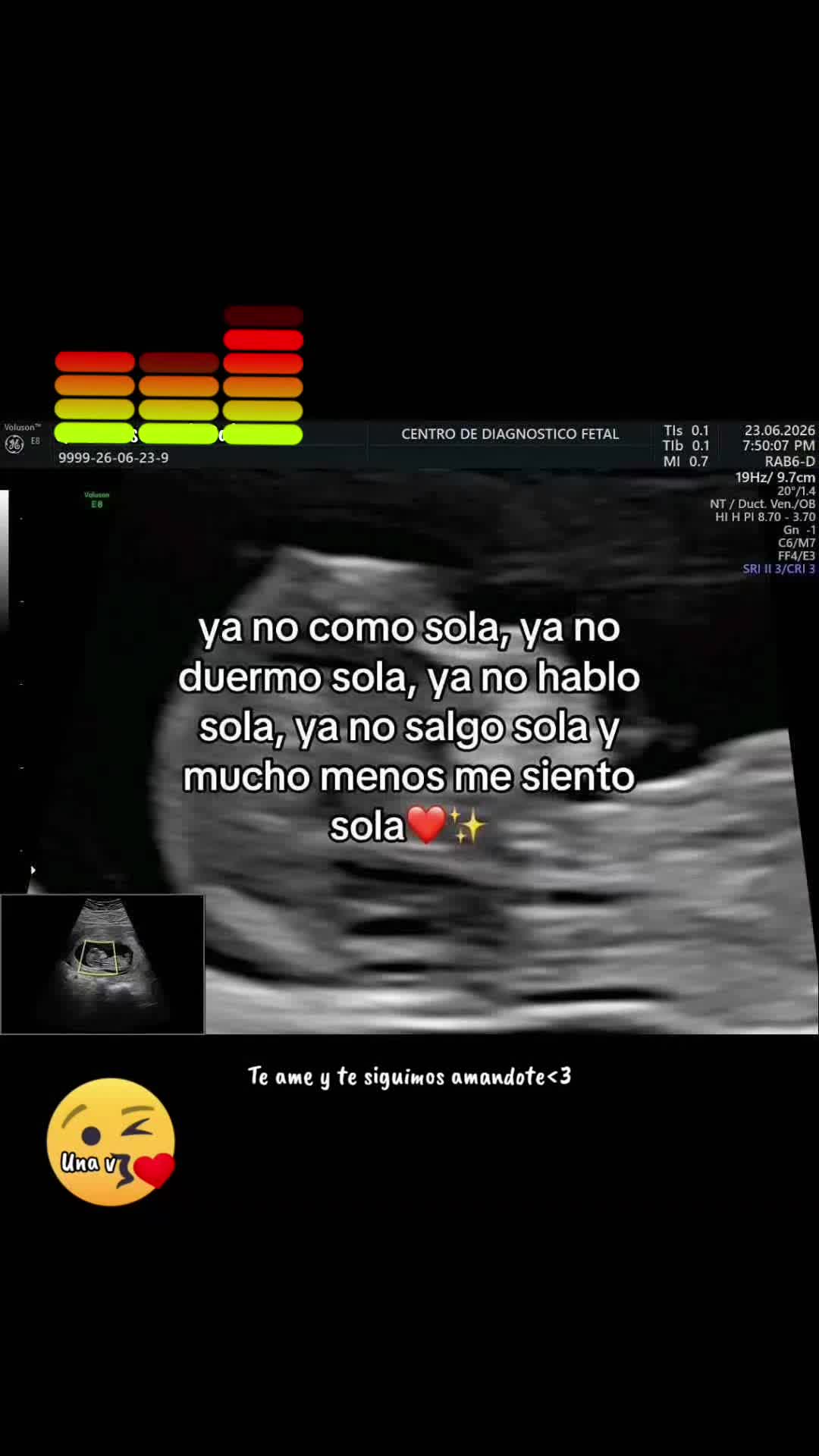 @🇵🇪👣 PEAS<1F🍒GIS&Egrave;LE_13👣🍃