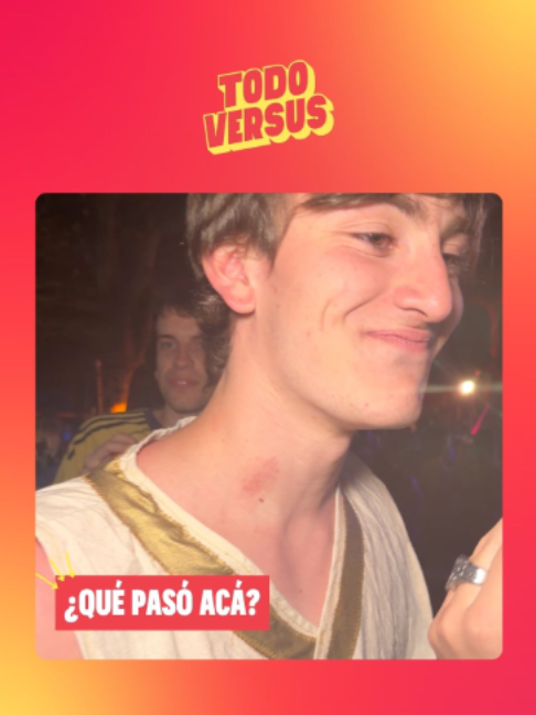 @Todo Versus