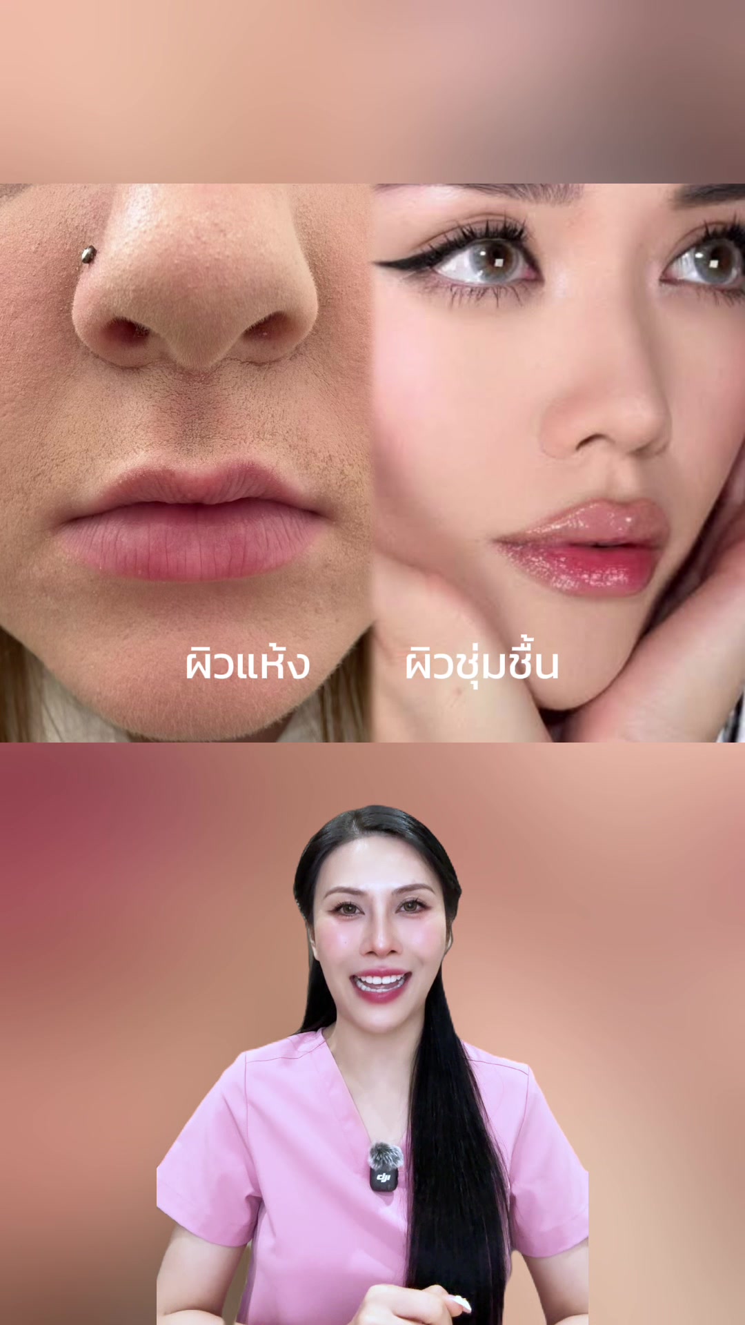 @พยาบาลอัญ