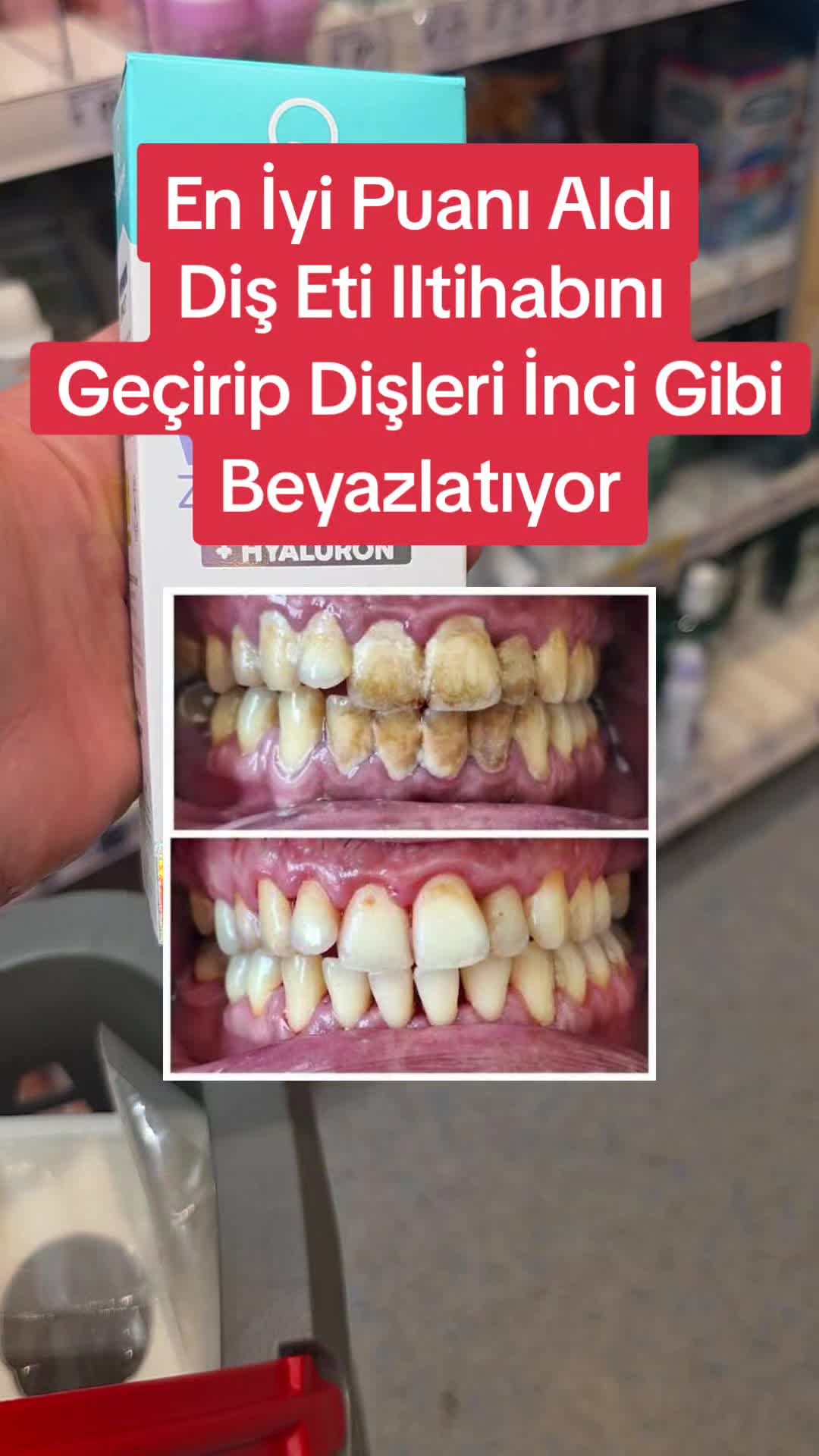 @Gurbet Ana