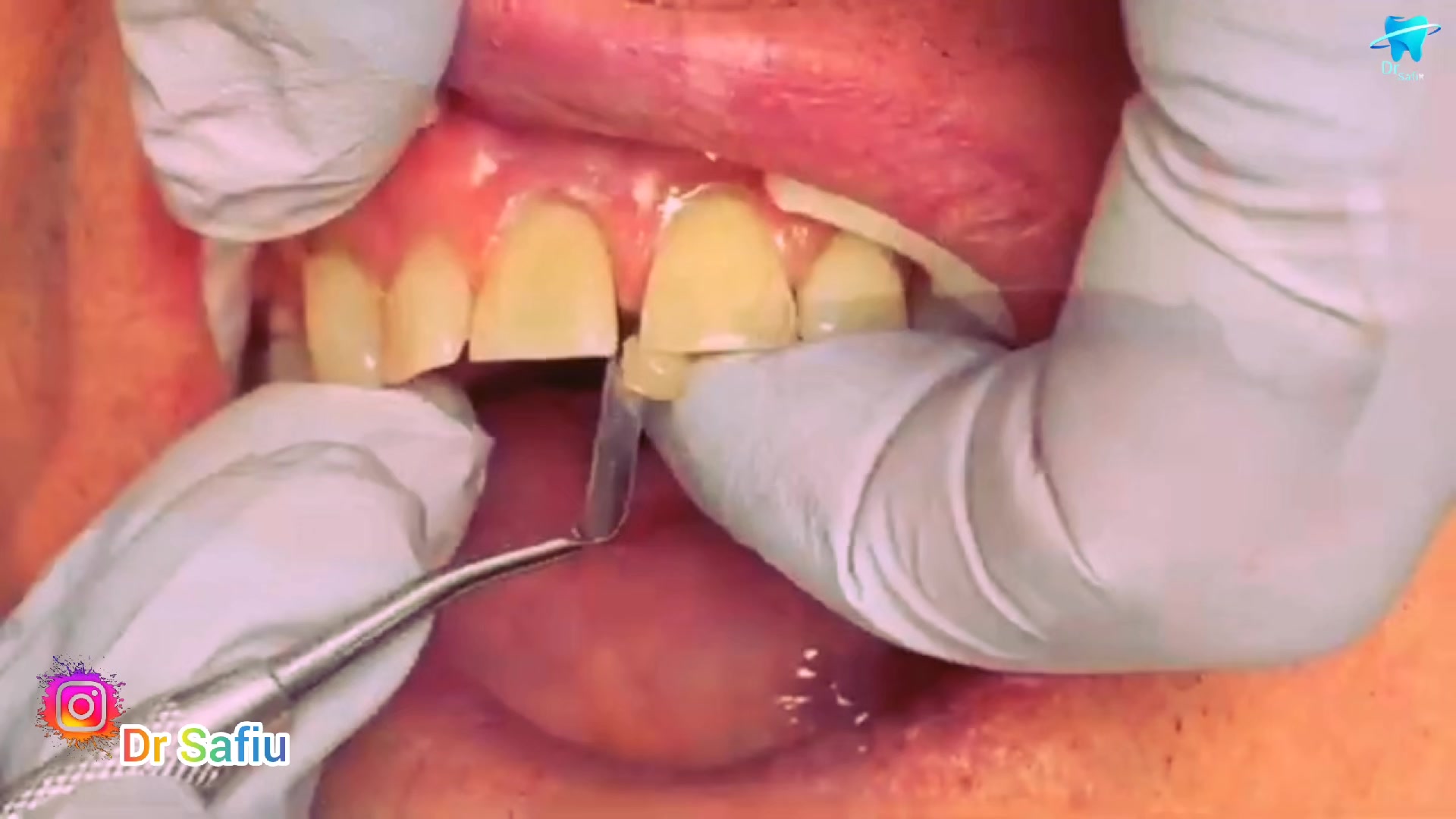 @Dentist 🦷