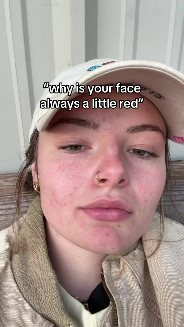 @fitty