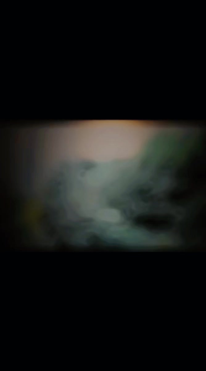 @ملنگ حلگ😔🚭