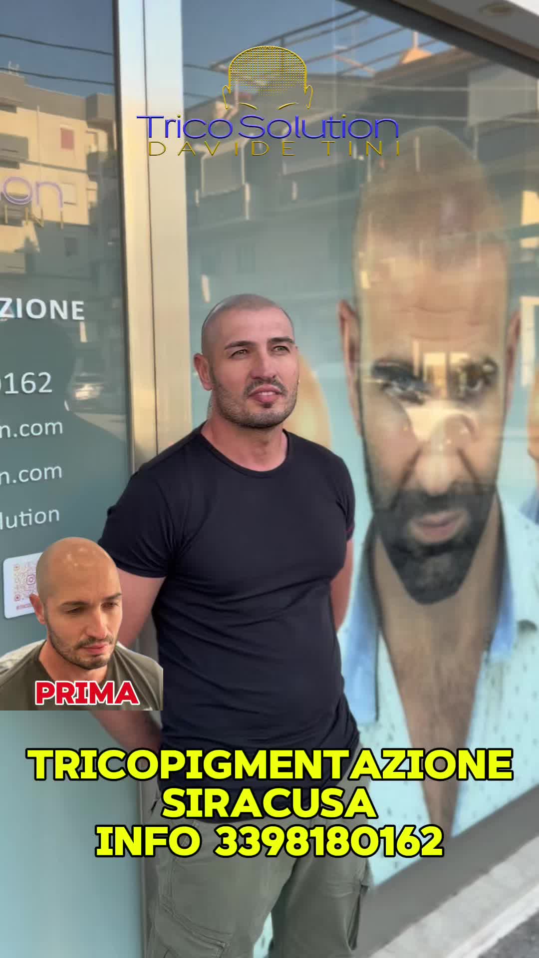 @TricoSolution di Davide Tini