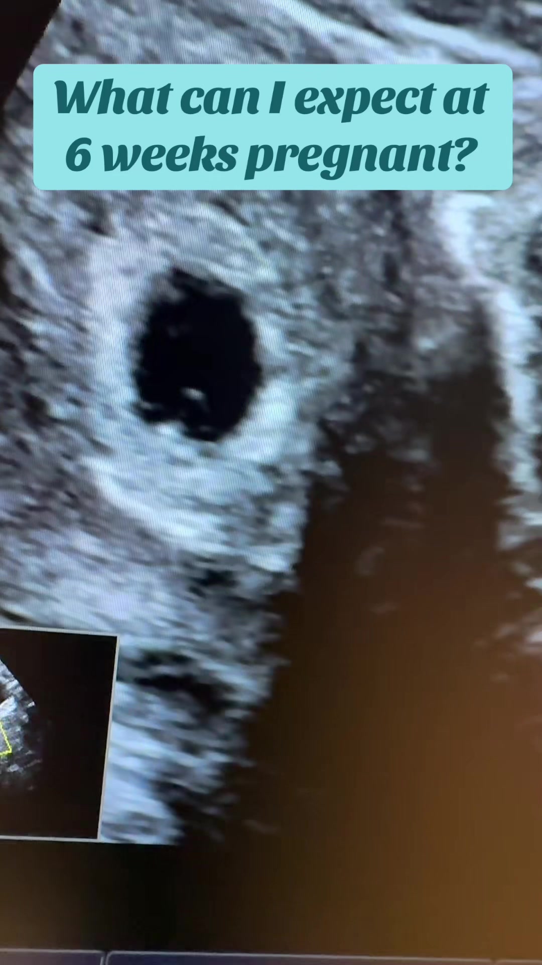 @PregnantSee Inc.