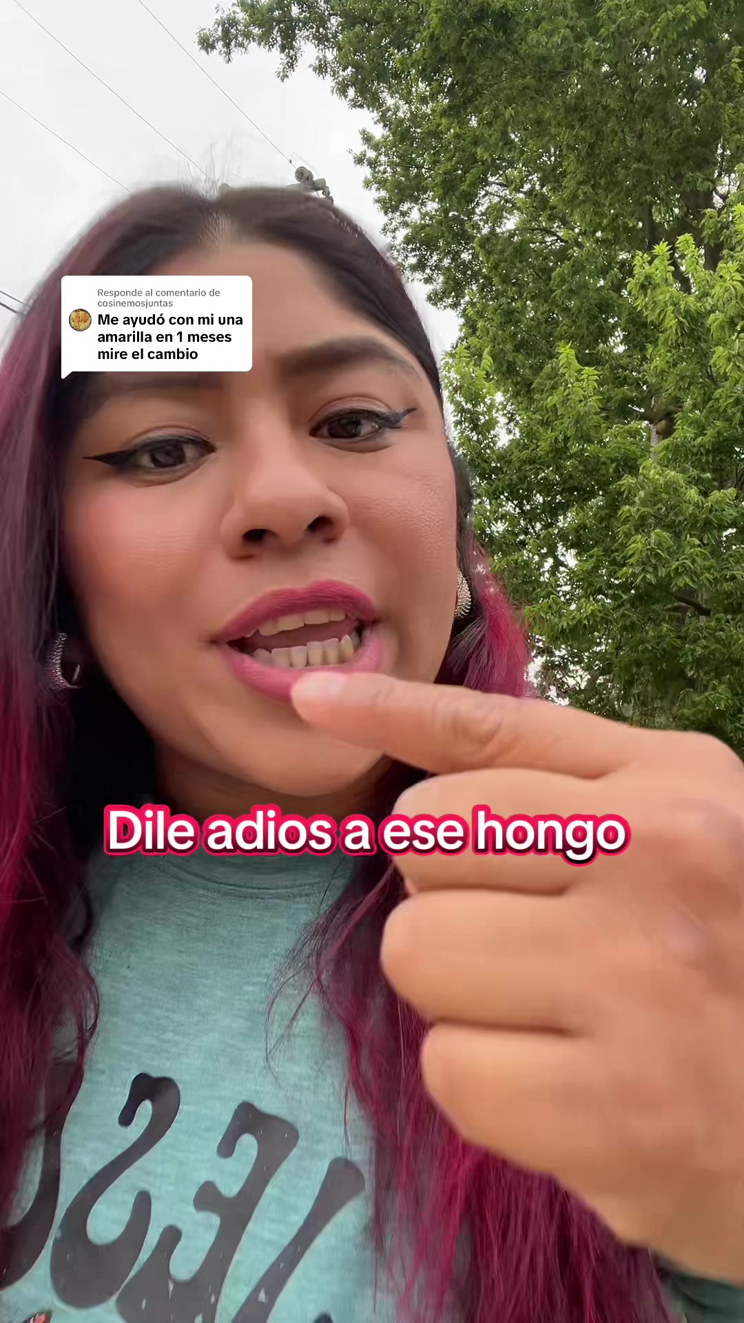 @fransisca