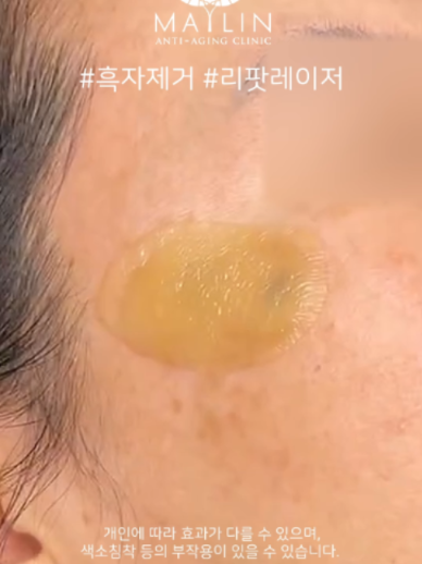 @메이린의원대구점