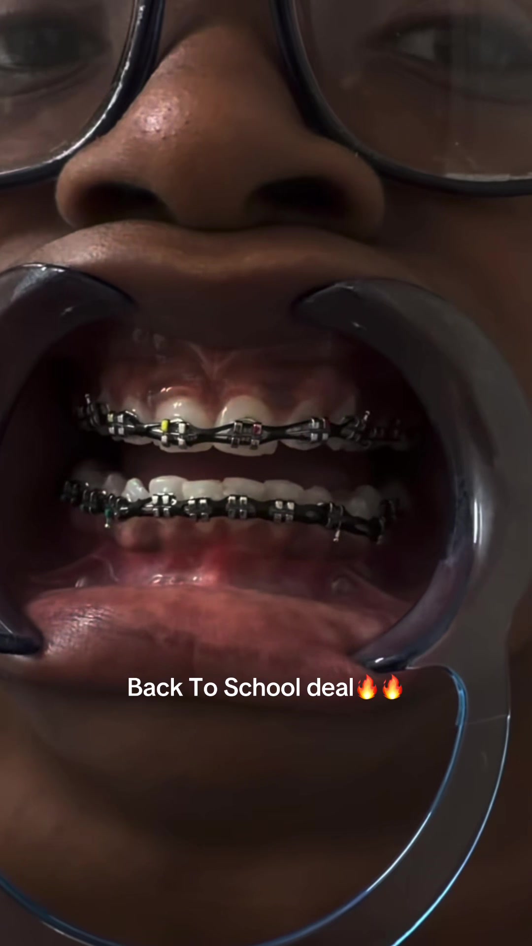 @bracesjunkie
