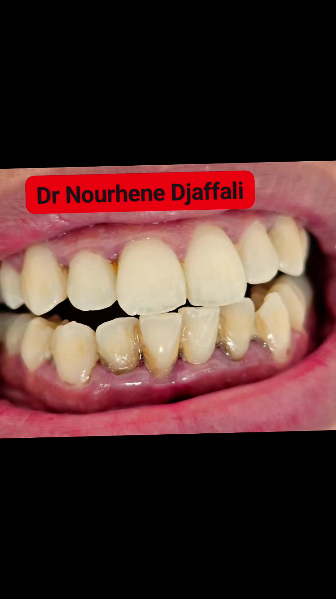 @Dr Nourhene Djaffali