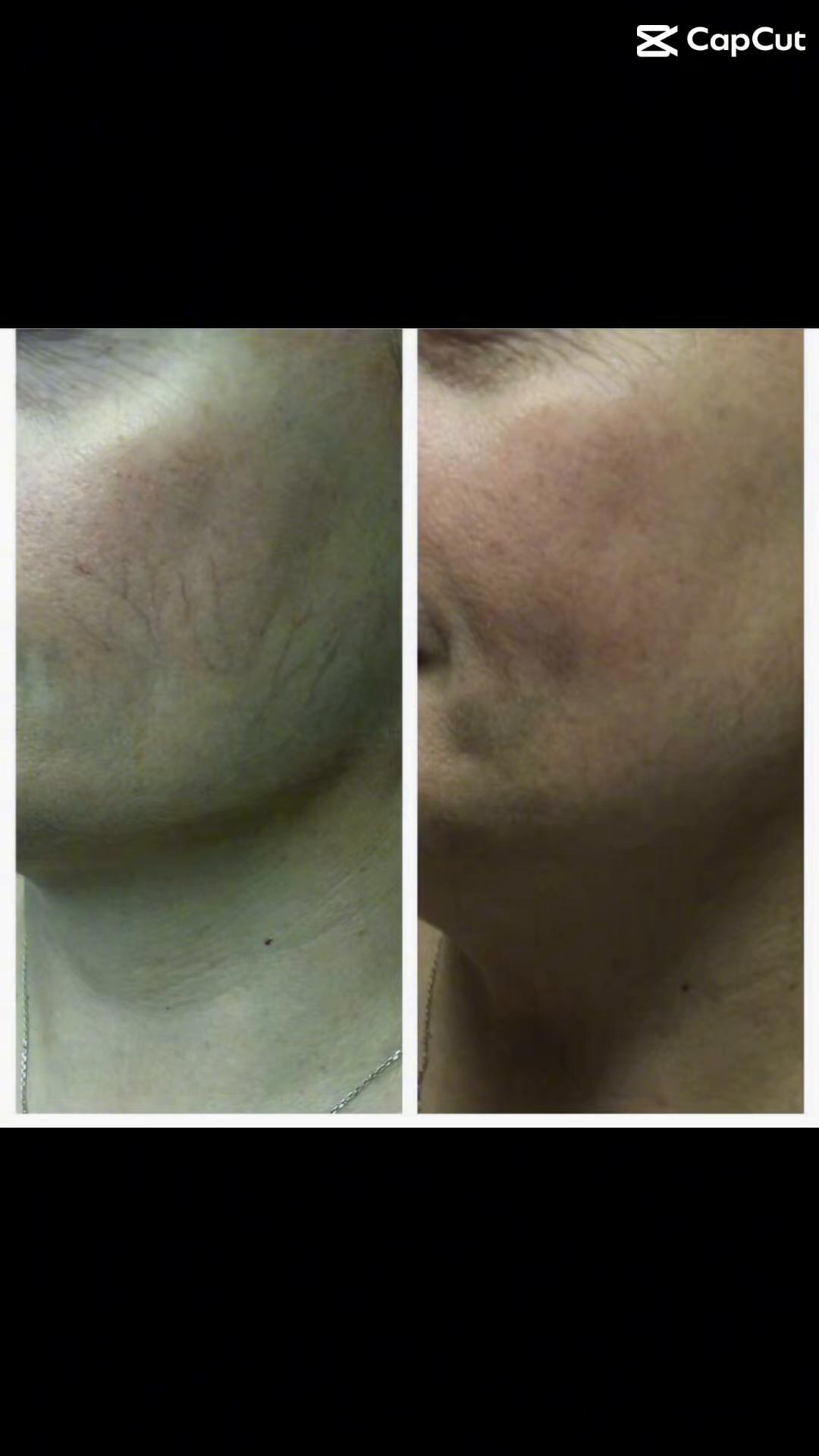 @Rosedermnyc