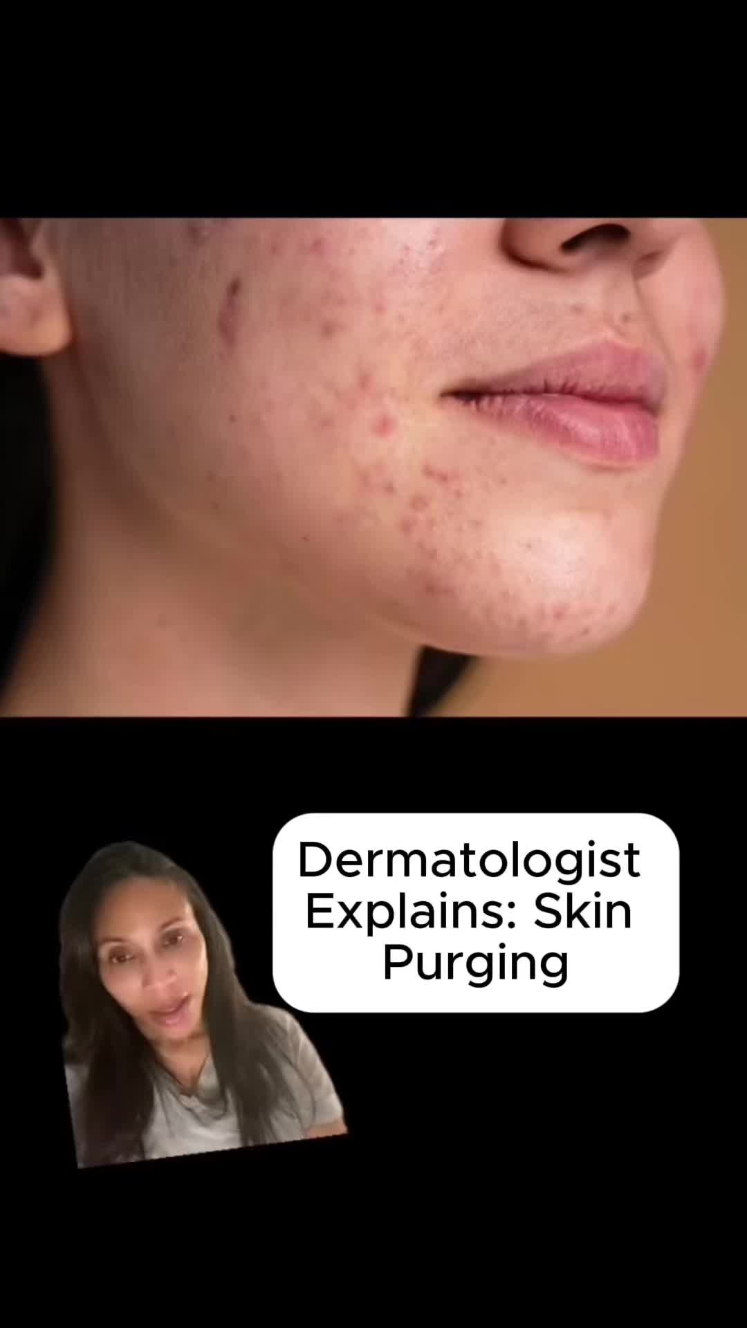@GlamDerm