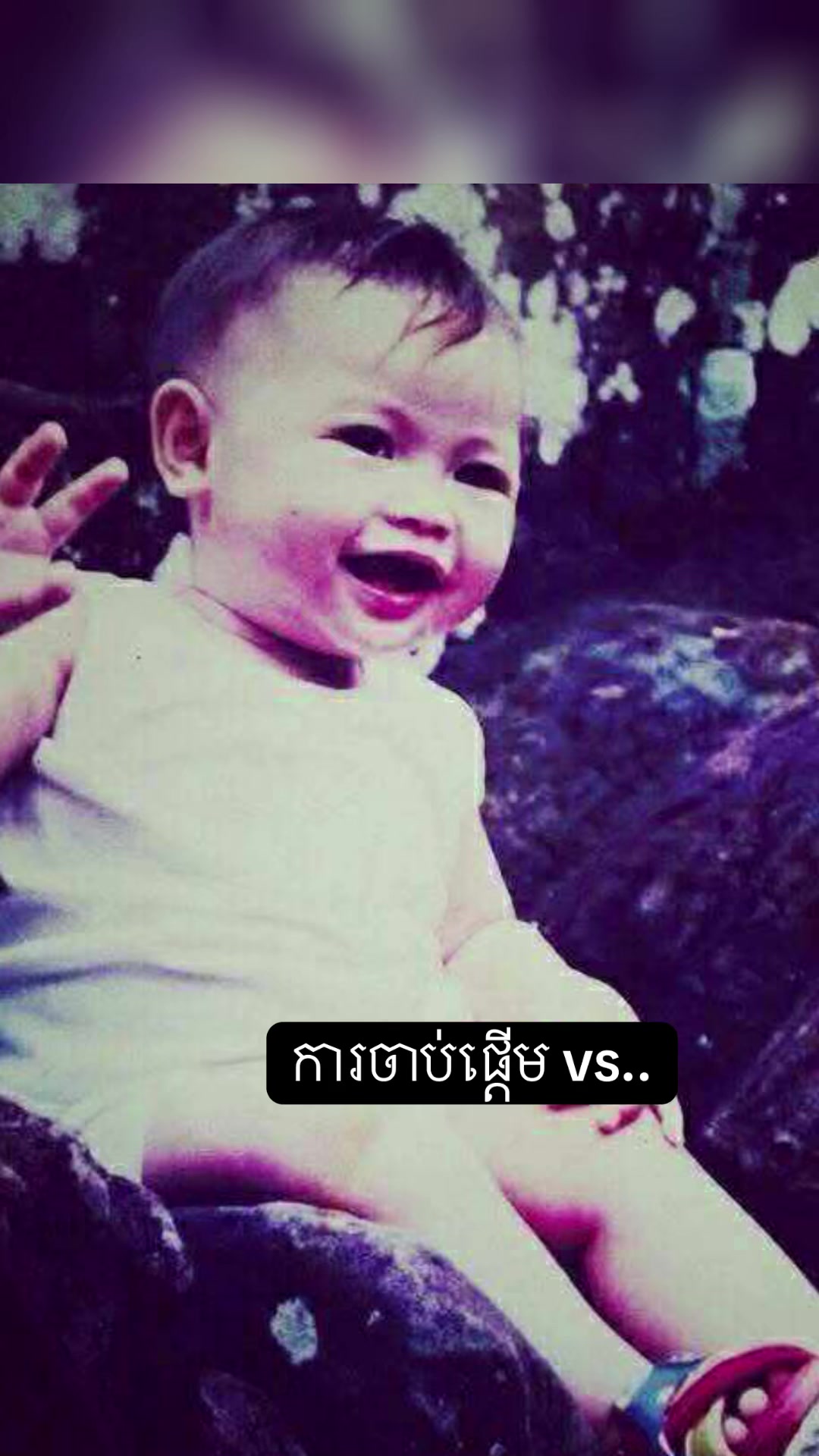 @Dr.Solidet-វះកាត់ឆ្អឹង