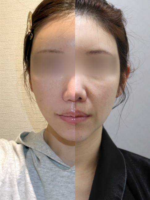@다시피움성형외과 DASIPIUM タシピウム