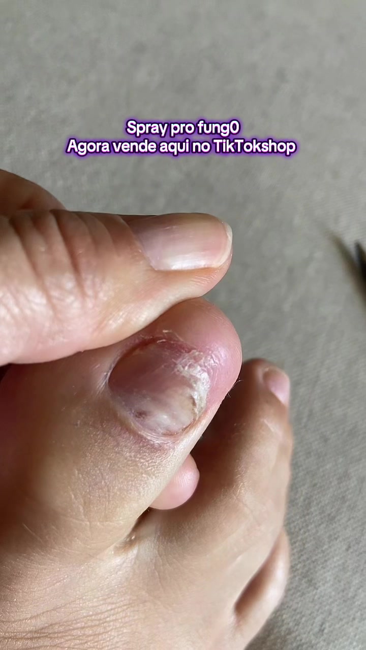 @Carolinaindica