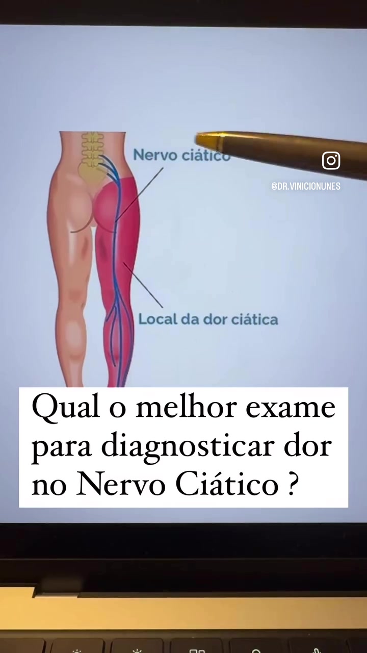 @Vinicio Nunes Nascimento