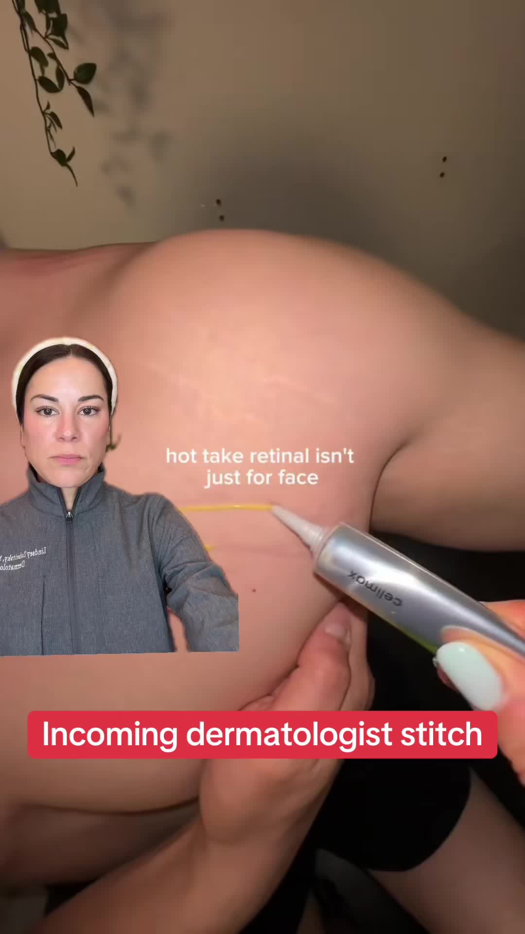 @Dermguru