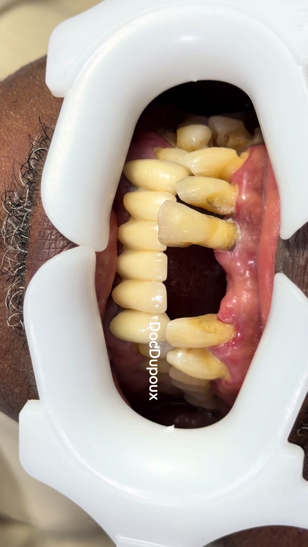 @DocDupoux