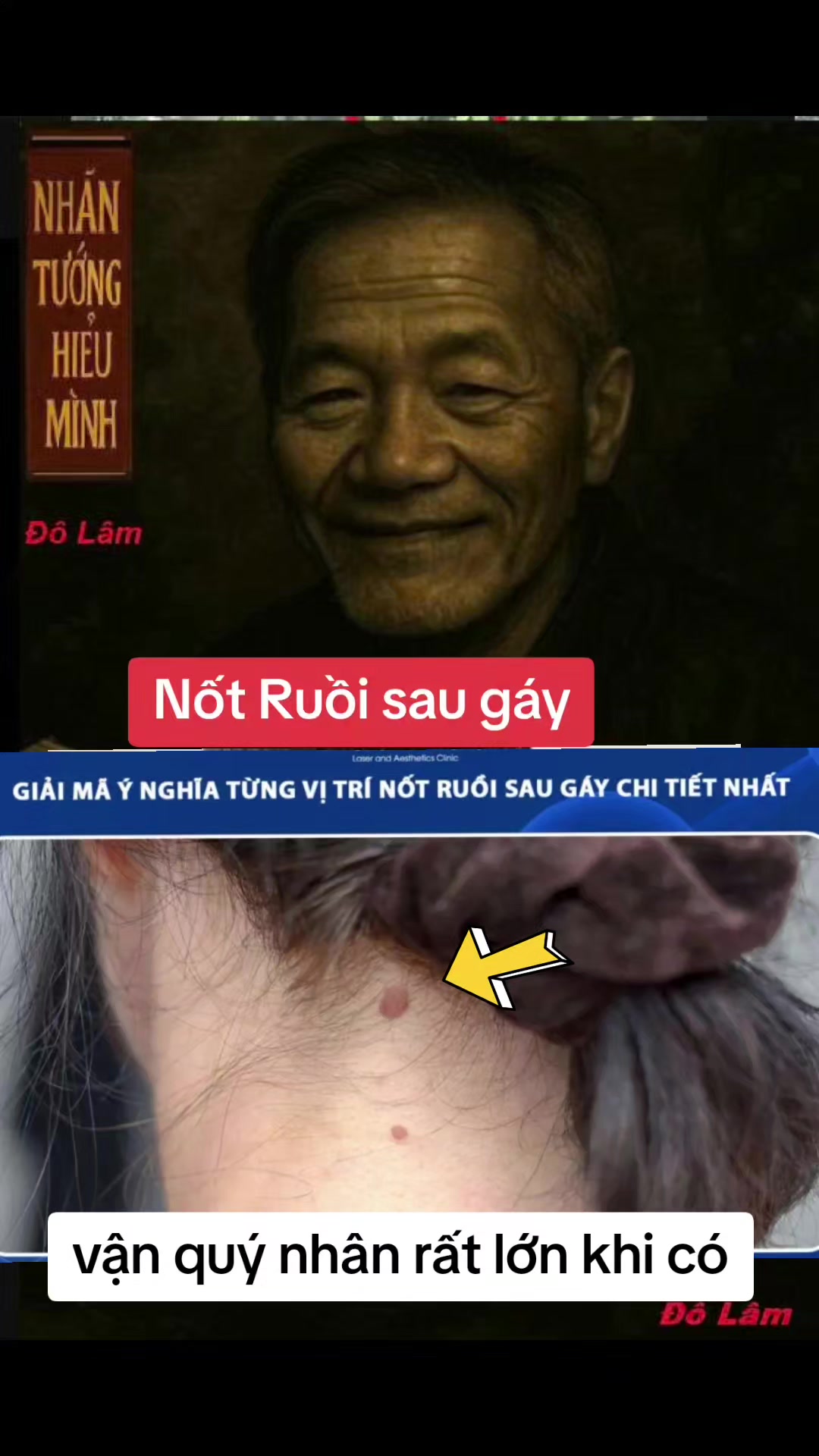 @Nhân Tướng Hiểu Mình