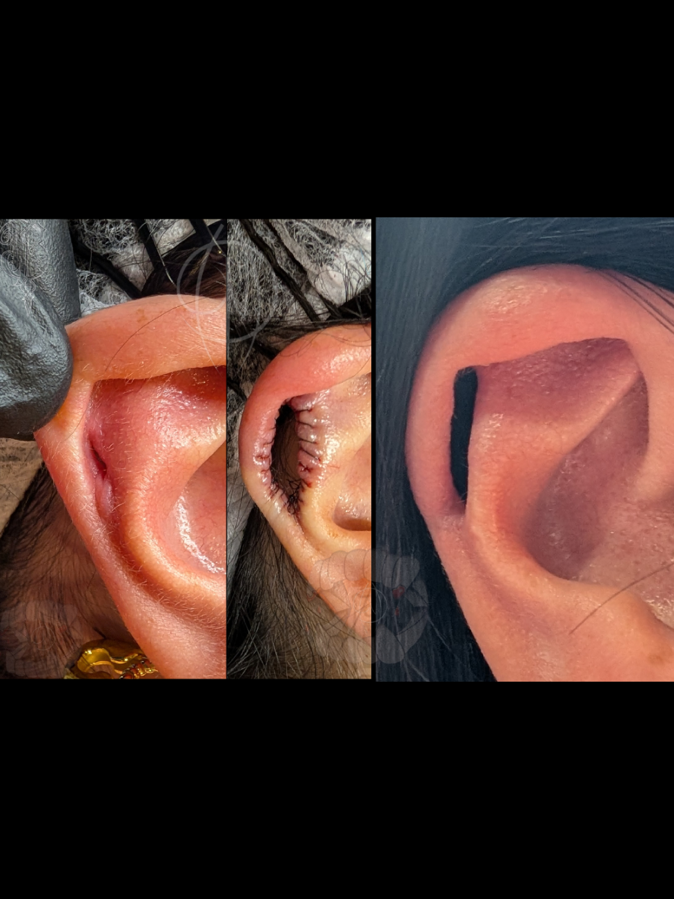 @Piercer Mike