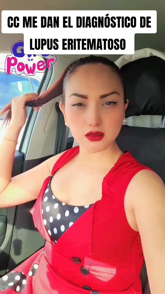 @Chris Inglés