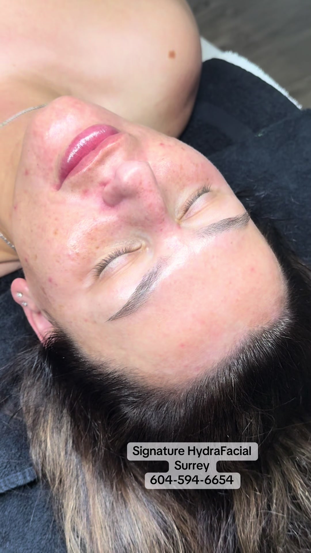 @Allora Laser & Spa