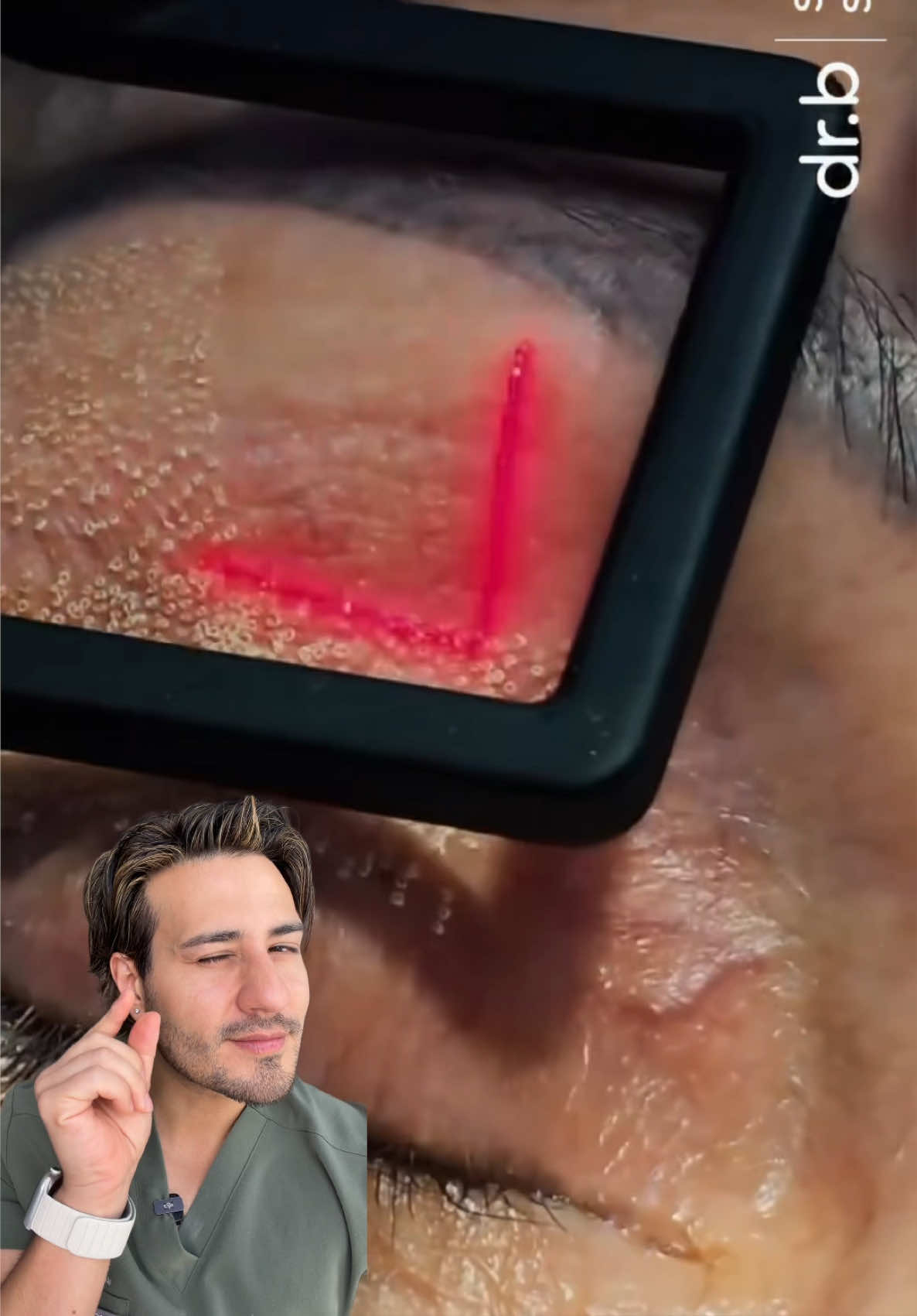 @chrisantiage