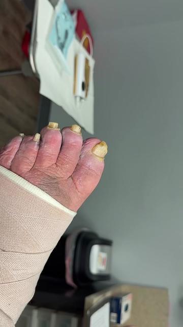 @Deniel Foot and Ankle Center