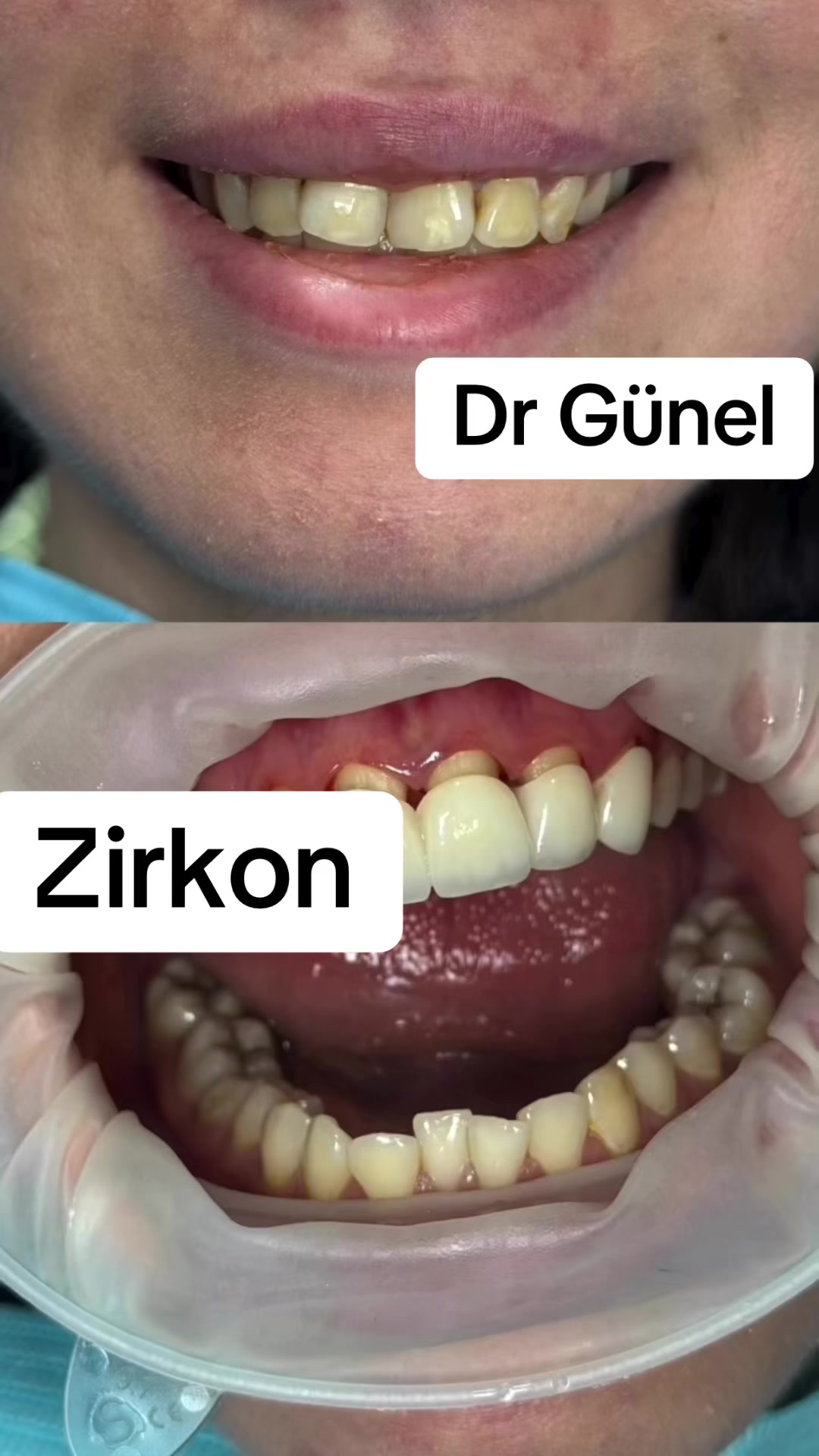 @Dentist_Günel
