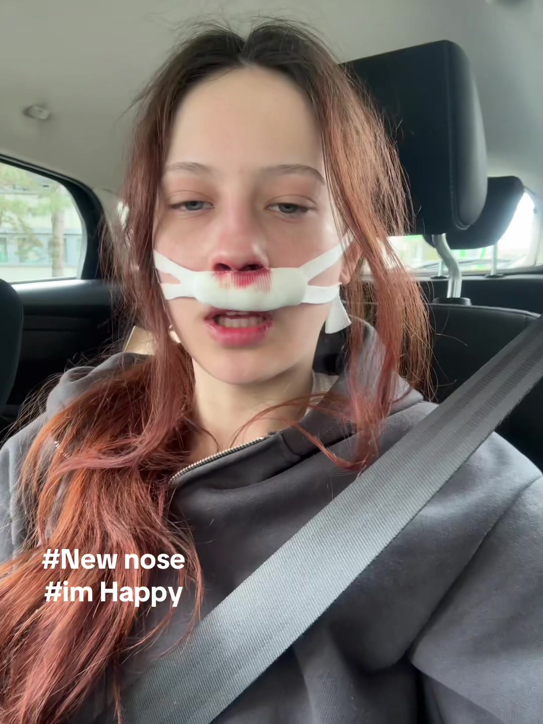 @lera
