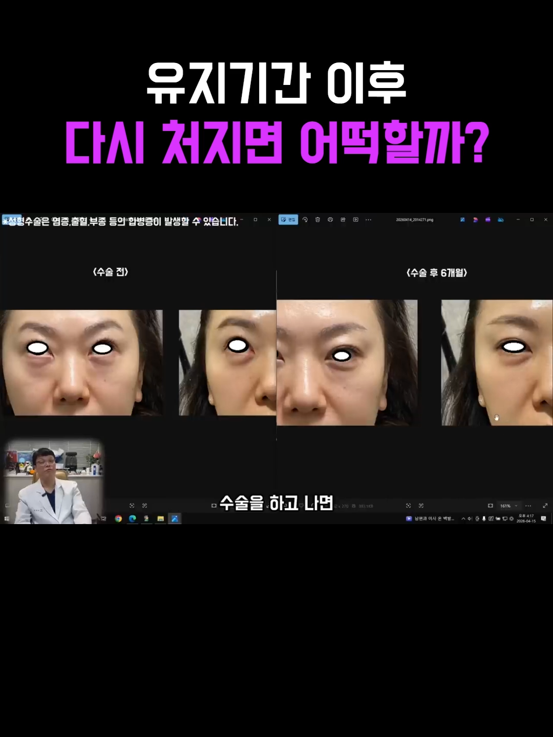 @미오름성형외과