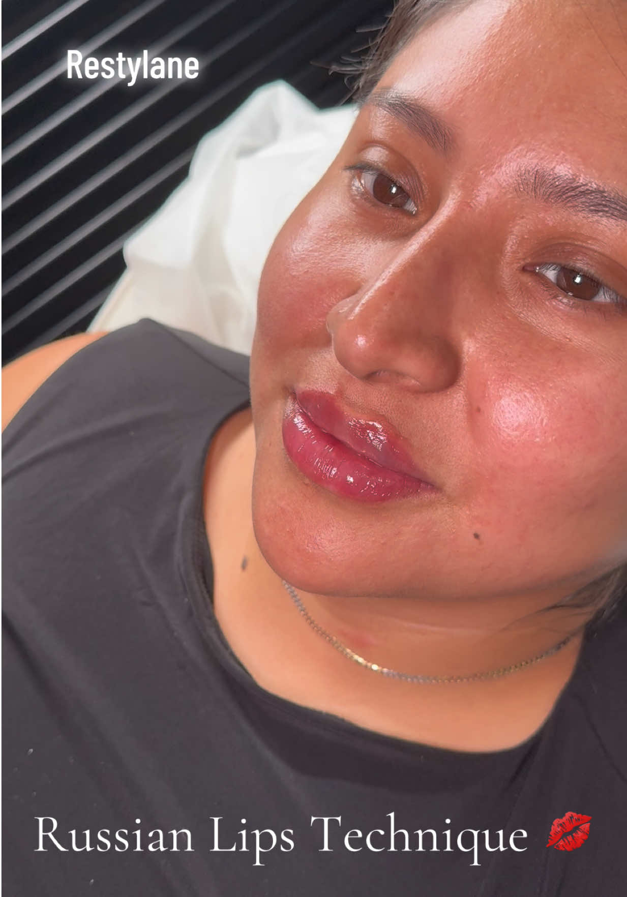 @Lips