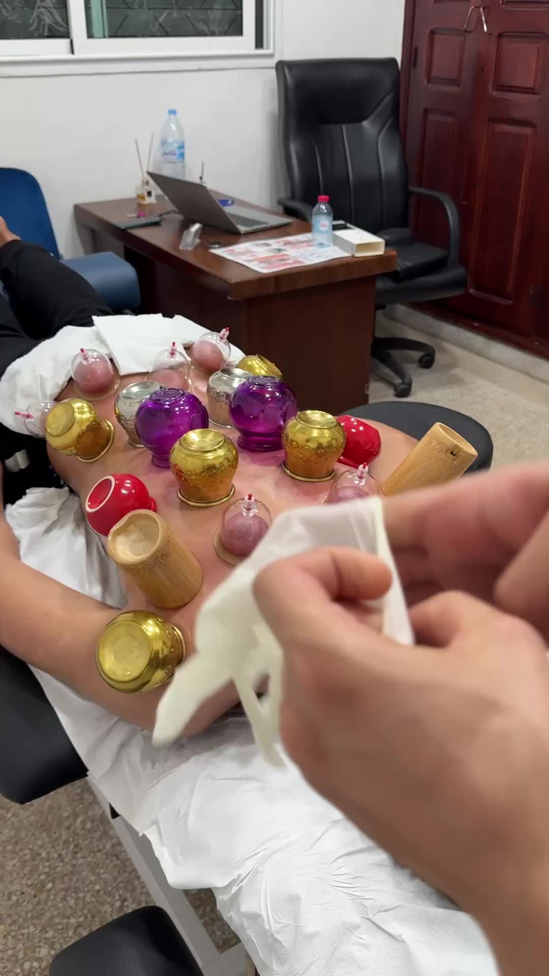 @Hijama.abdelmajid