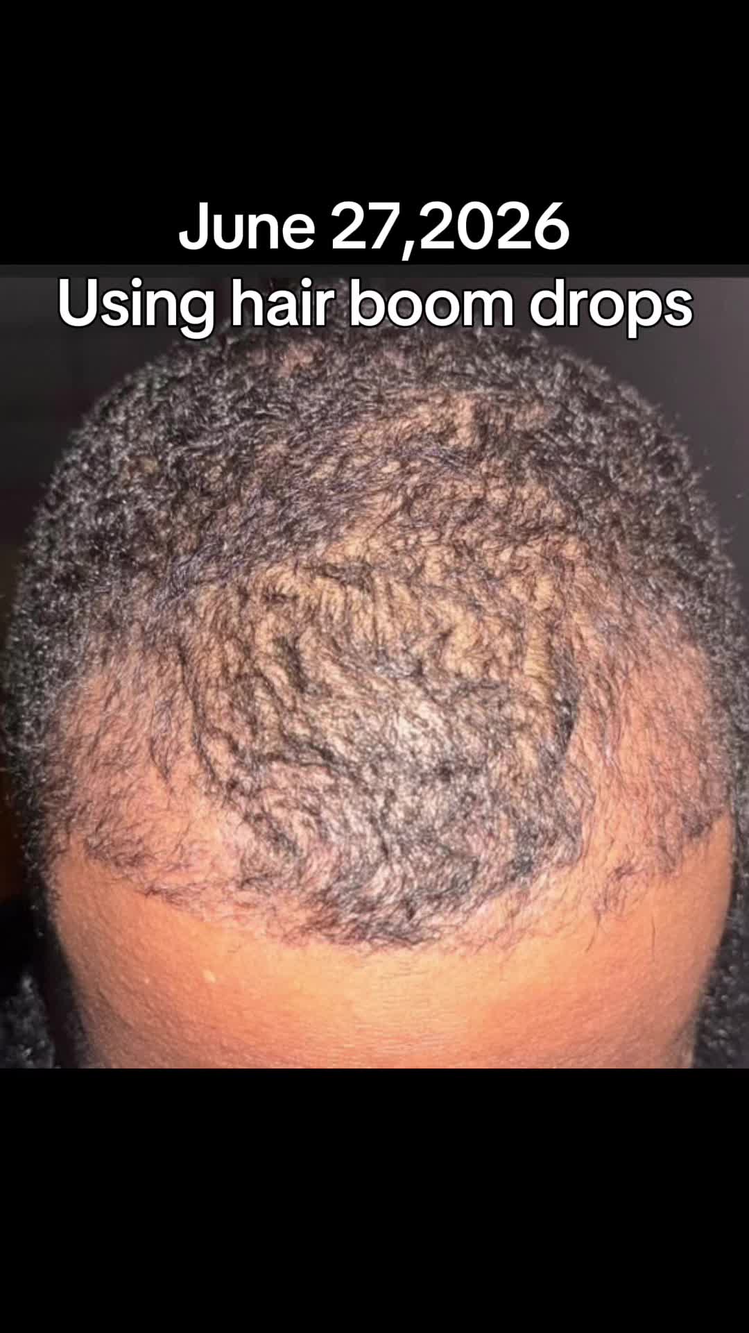 @Amazing Hair Care