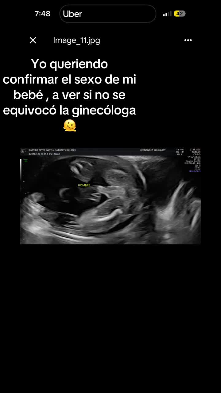 @Territo 🦊 & Tadeo 👶🏻💙💙