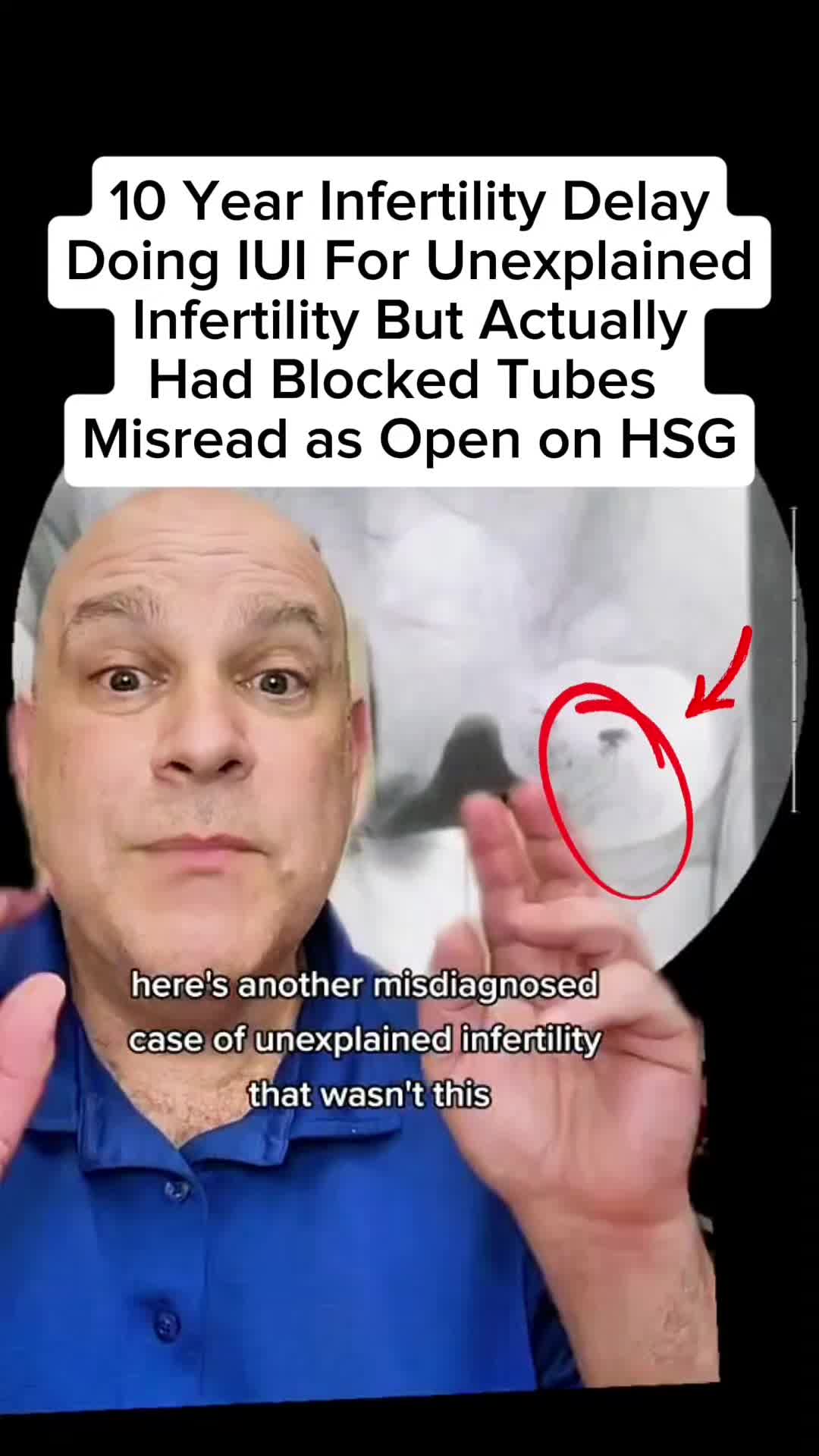 @Steven Palter, MD
