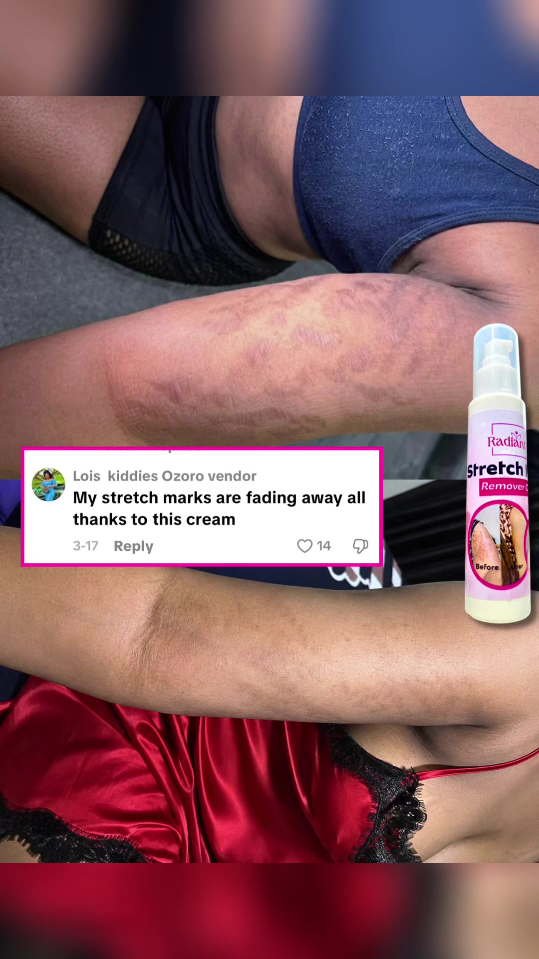 @Radiant skin
