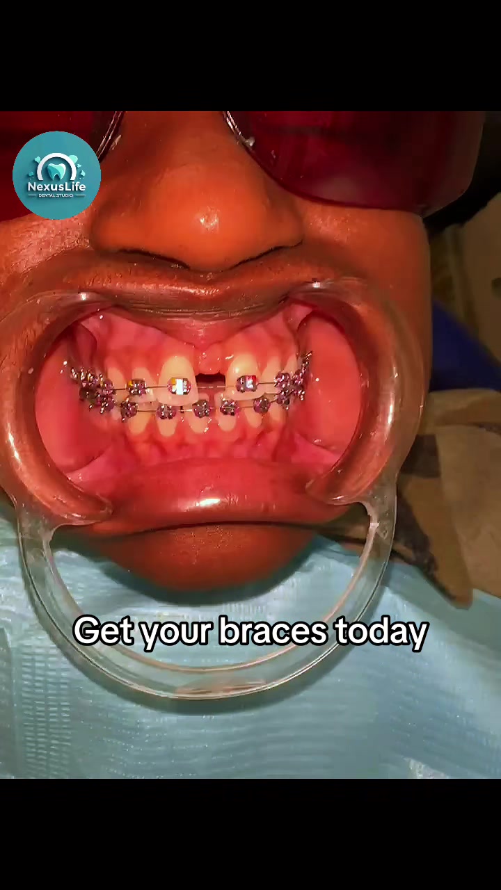@NEXUSLIFE DENTAL CLINIC🦷