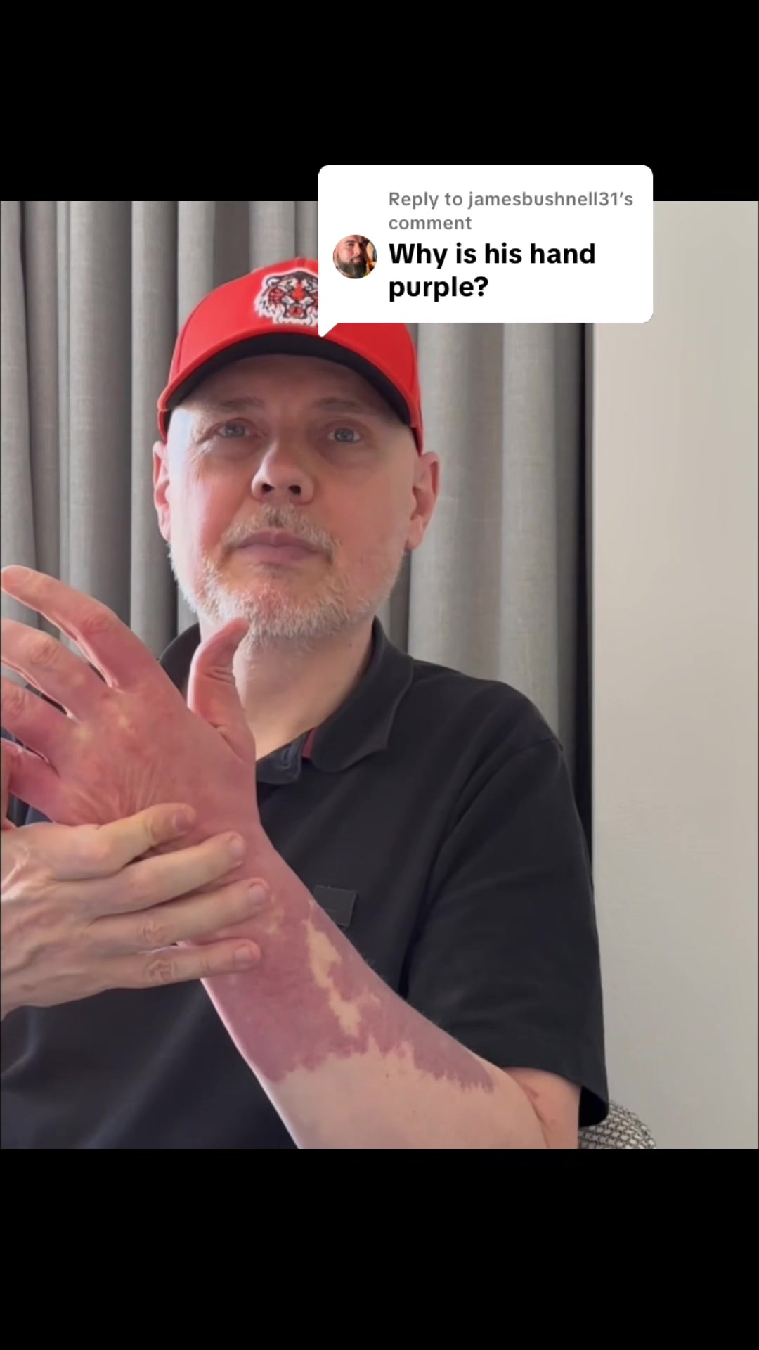 @Billy Corgan