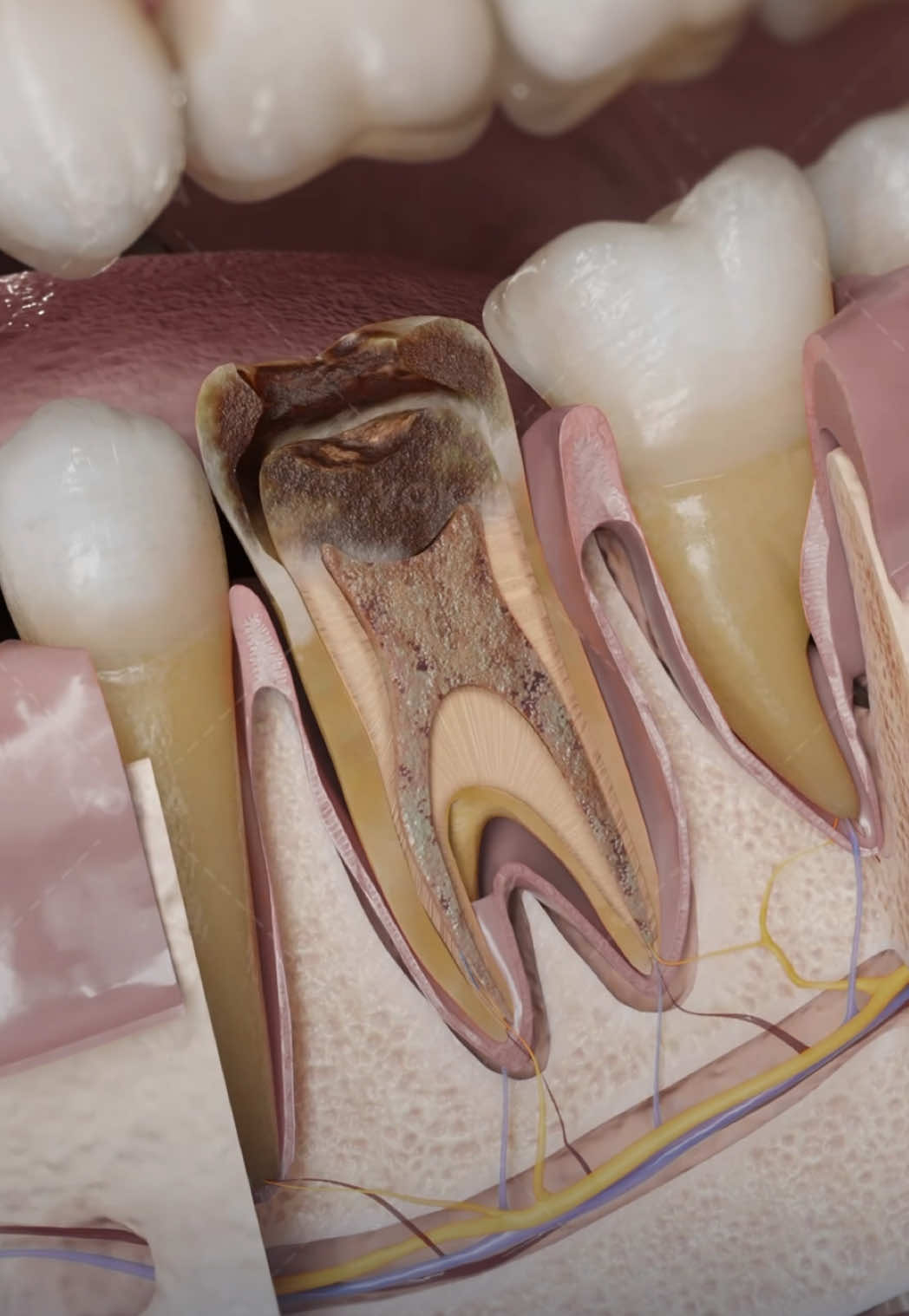 @VOKA 3D Anatomy & Pathology