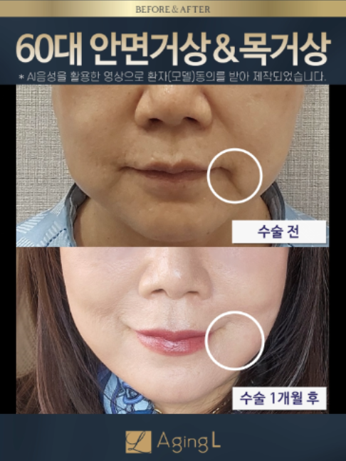 @agingl_official