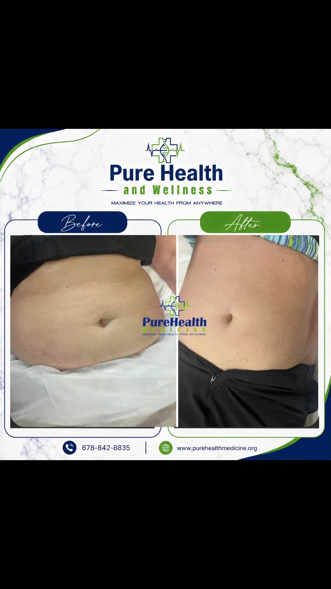@PureHealthand_Wellness