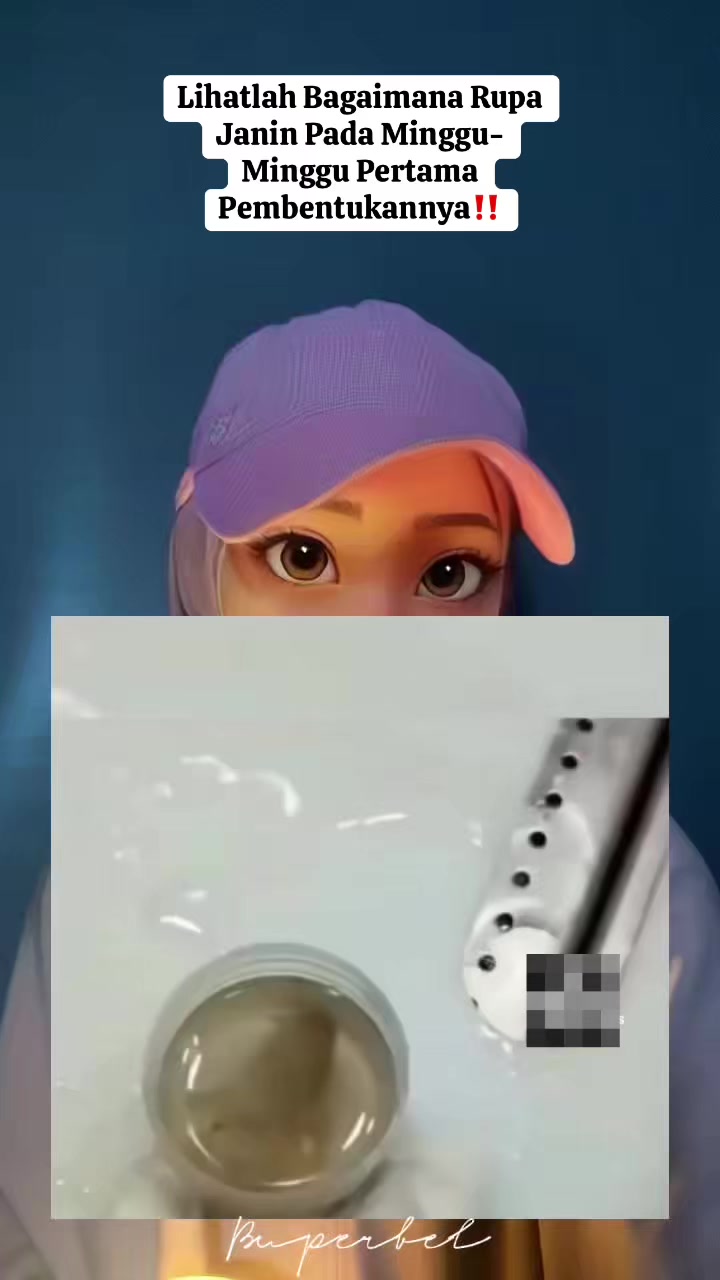 @B U P E R