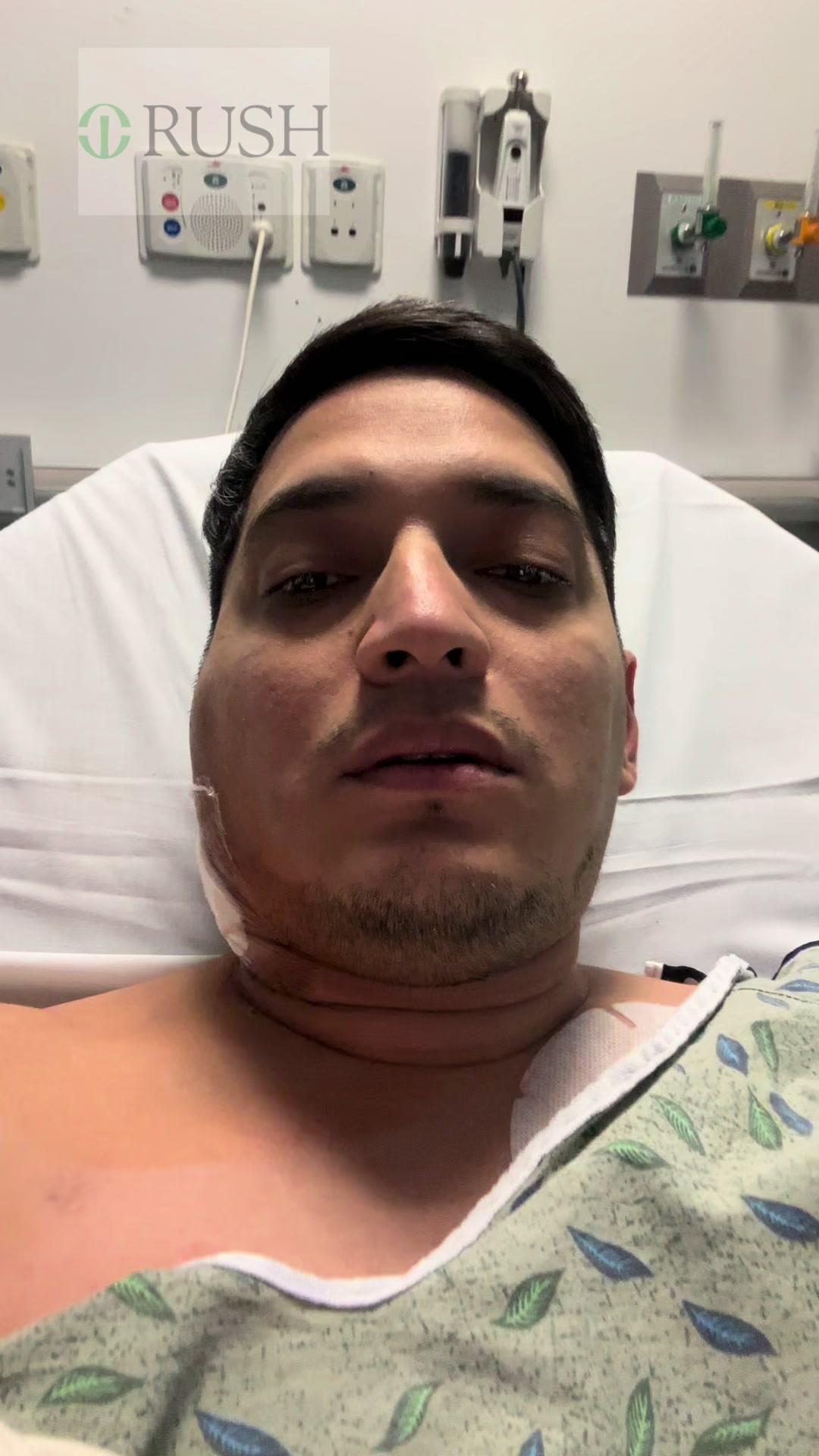 @Angel Gomez Linfoma