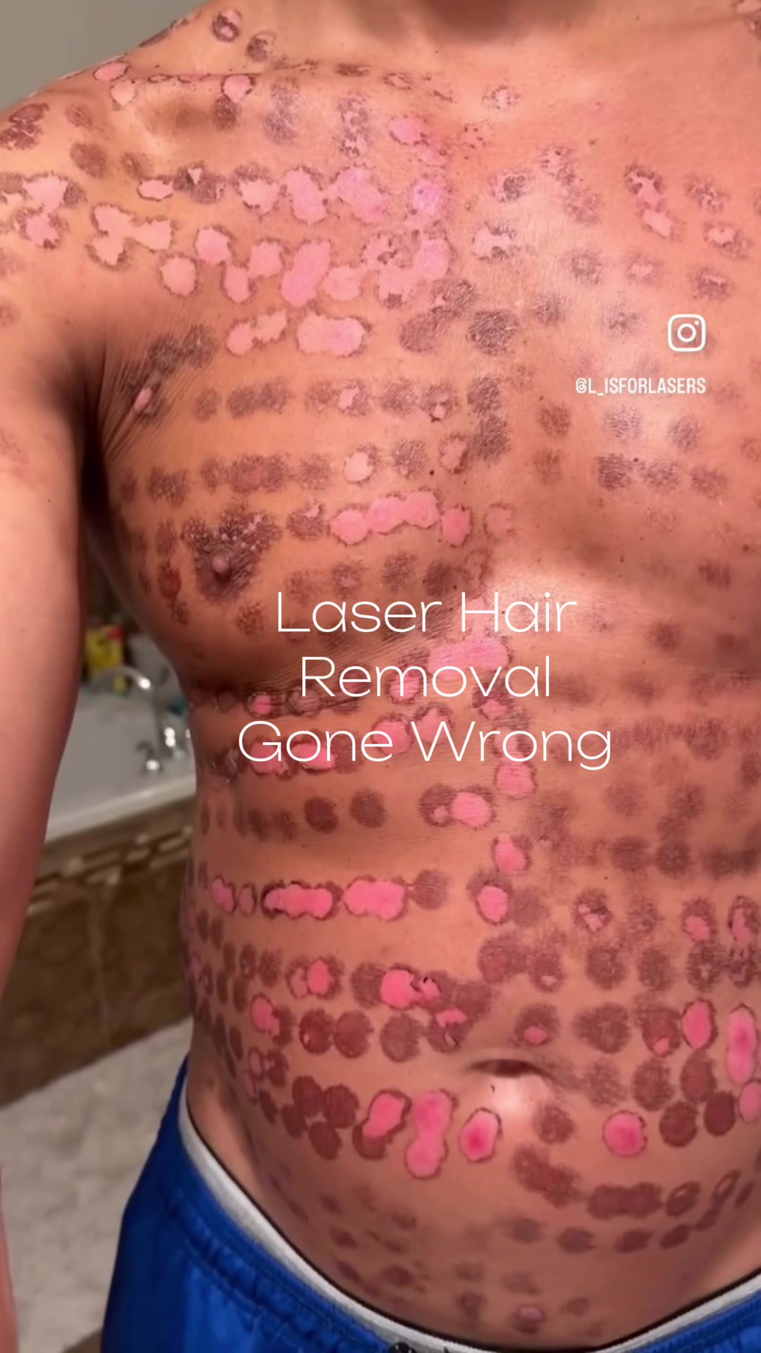 @Pure Skin OC