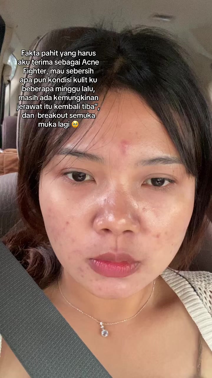 @ichi | glow up journey