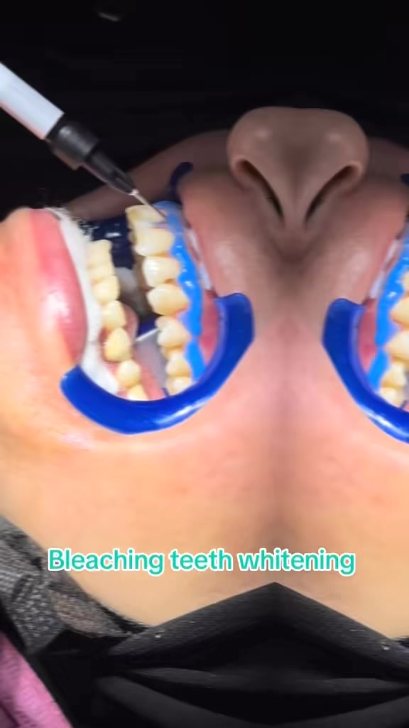 @Dr RahmatullahDental surgeon