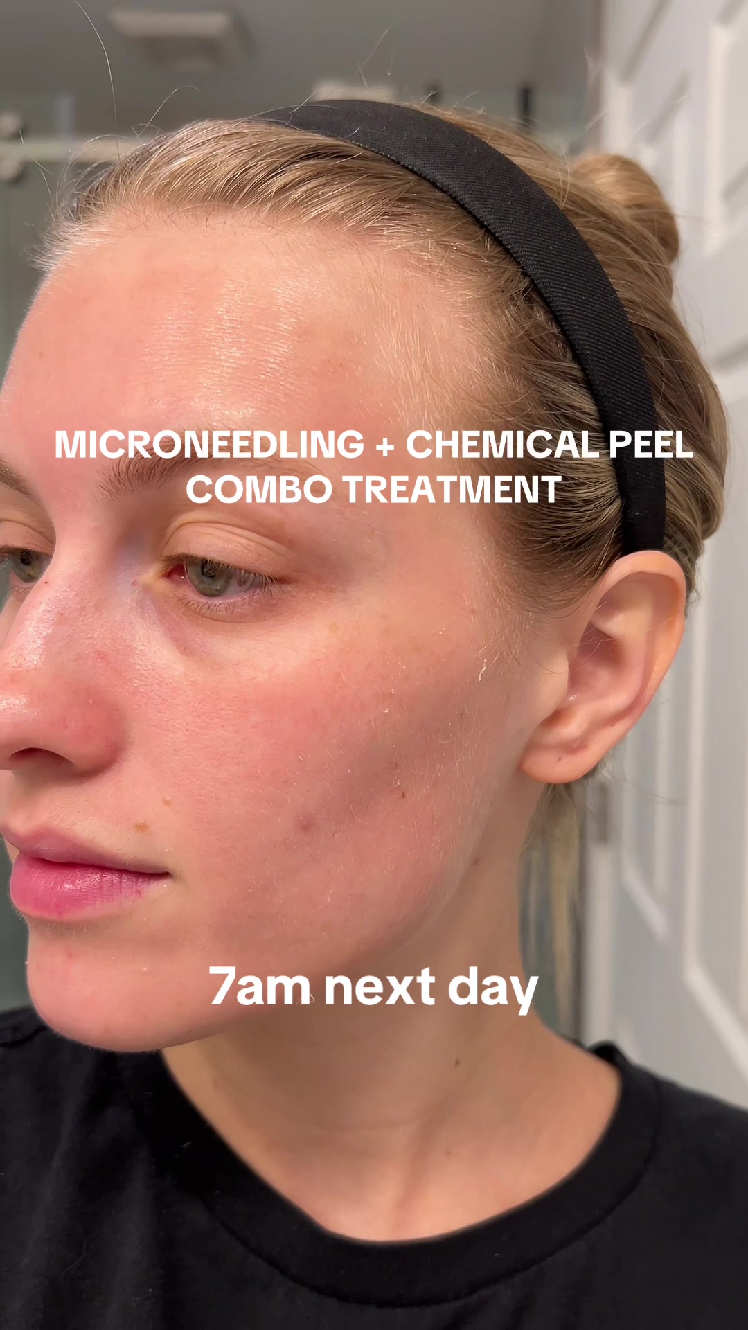 @alaina | FL esthetician