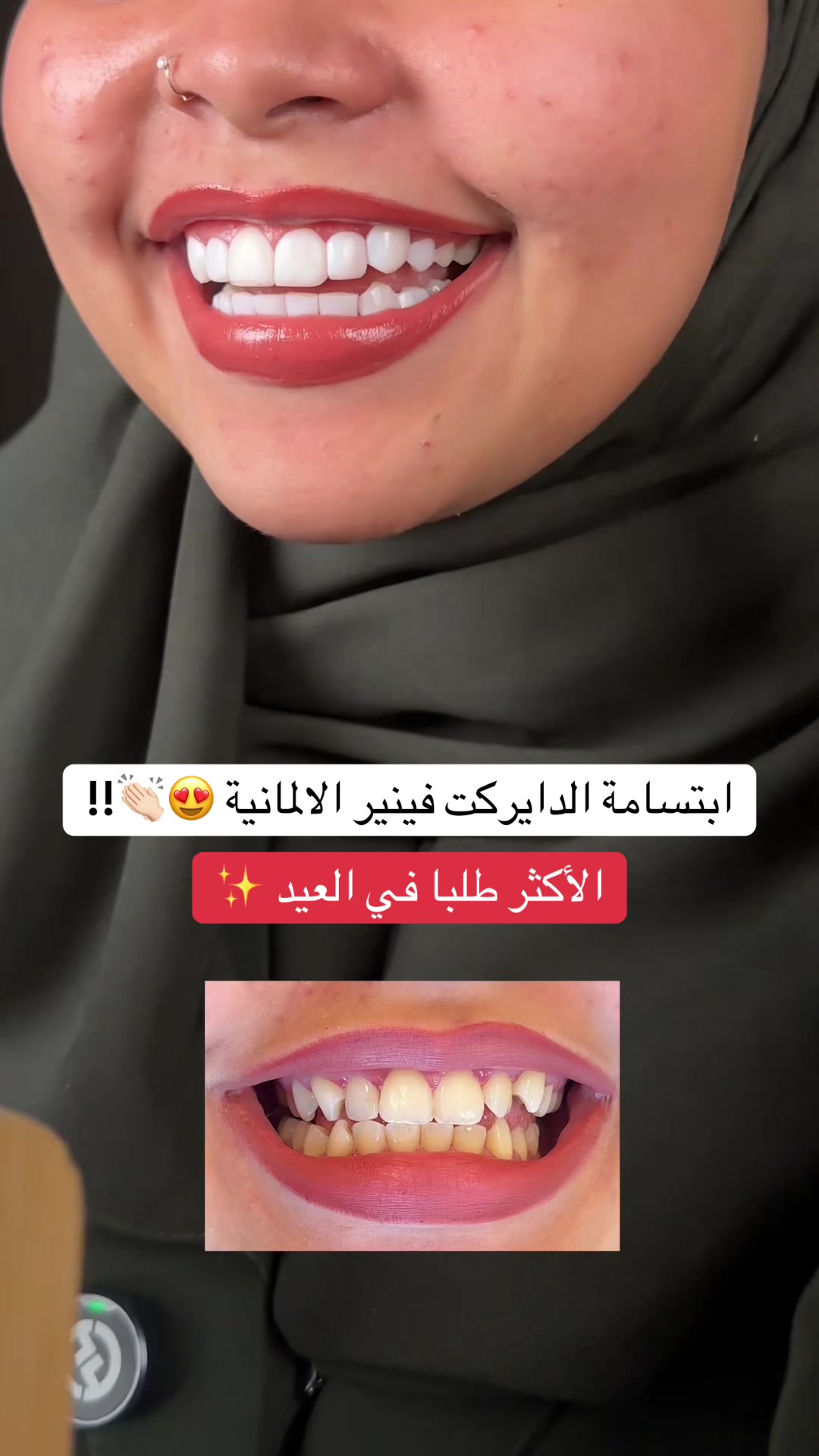 @Dr.lina_almasmoum